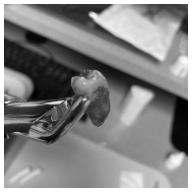 The tooth